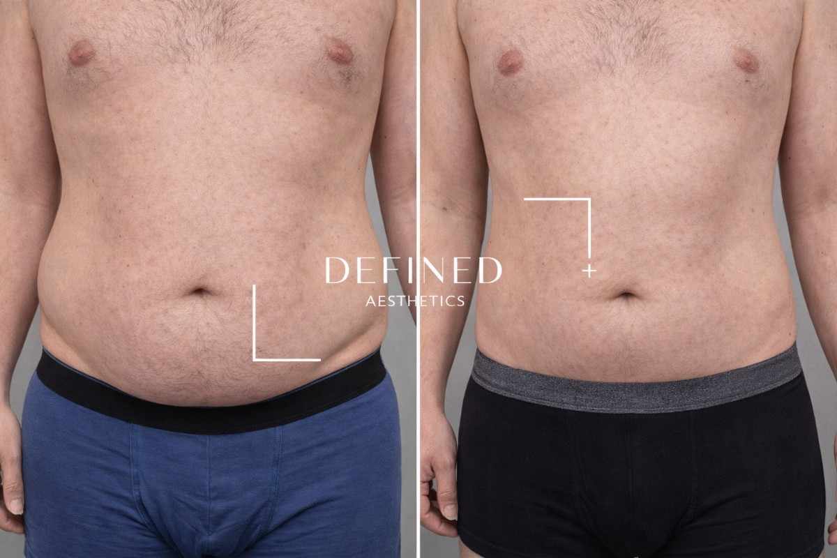 Ongoing transformation 3