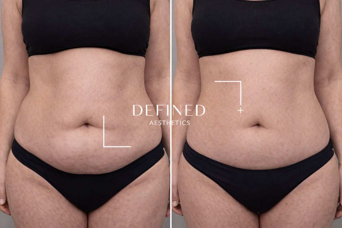 Ongoing transformation 2