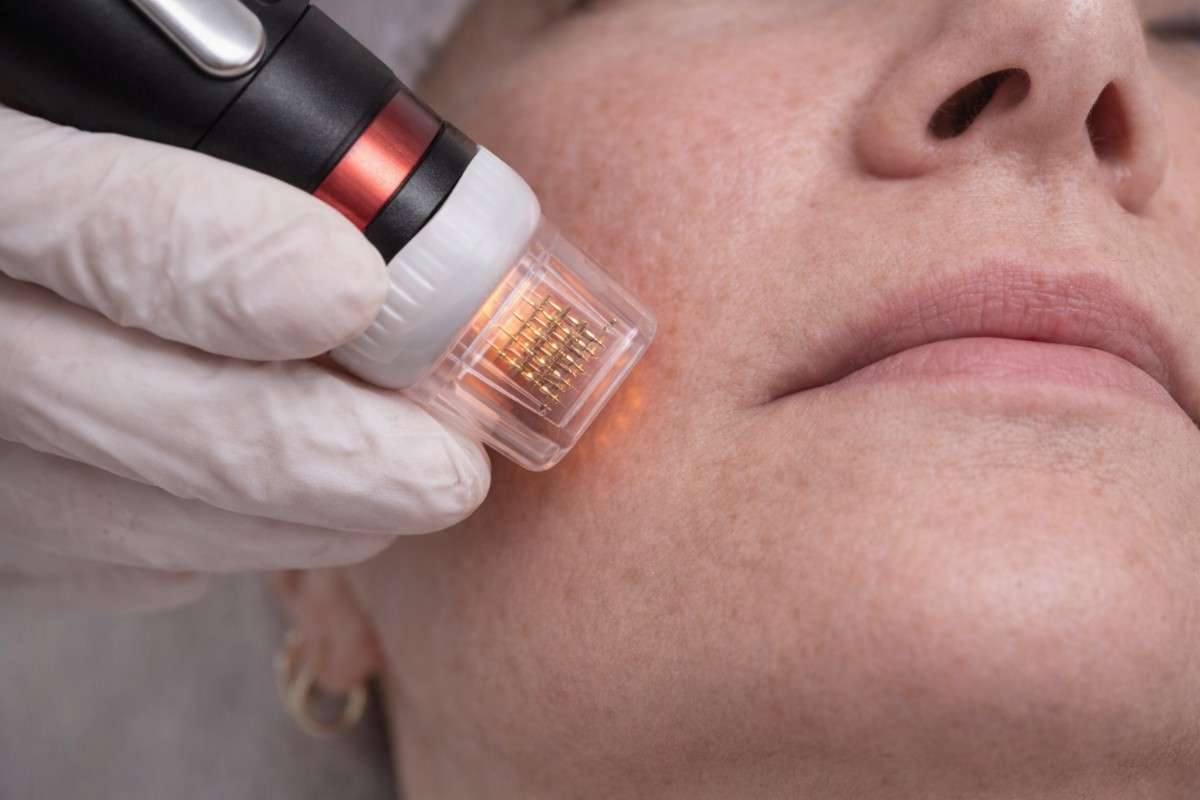 Ongoing transformation 4